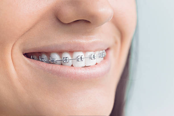 Trusted Rancho Santa Fe, CA Dental Services Experts